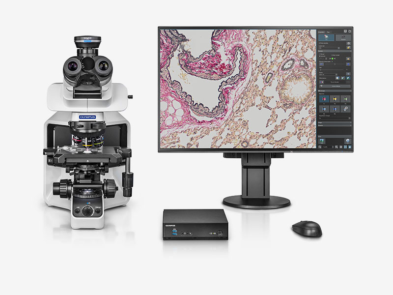 Mikroskopkamera, Olympus DP23 m. DP2-AOU Stand-Alone Unit, 6.4 MPx, 1/1.8", Farve